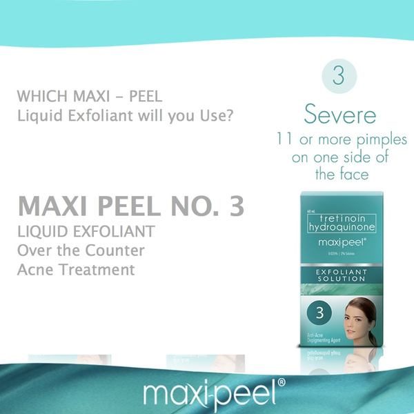 Maxi-Peel #3